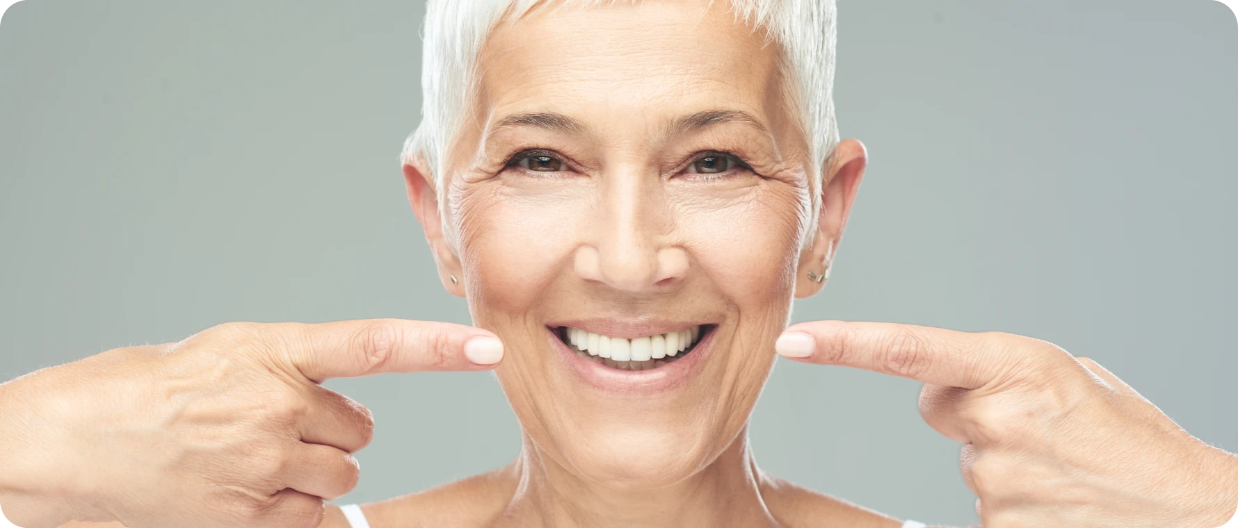 aligneurs biarritz chevauchement dentaire aligneurs biarritz chevauchement dentaire Hygiène bucco-dentaire Dr Loustau-Dessus