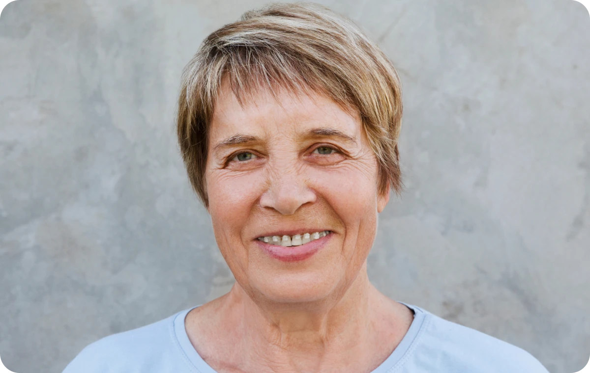 appareils dentaires ceramique biarritz senirs appareils dentaires ceramique biarritz senirs Appareils dentaires (métal et céramique) Dr Loustau-Dessus