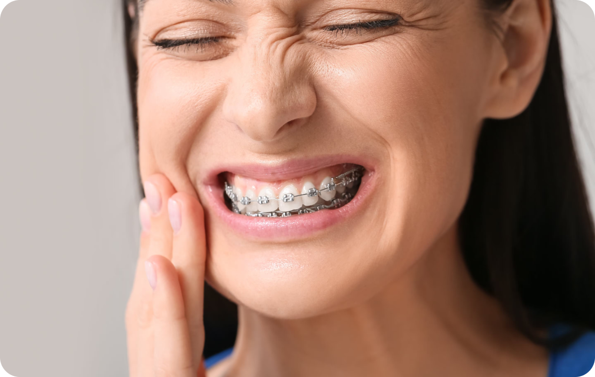 appareils metal ceramique biarritz chevauchement Appareils dentaires Dr Loustau-Dessus