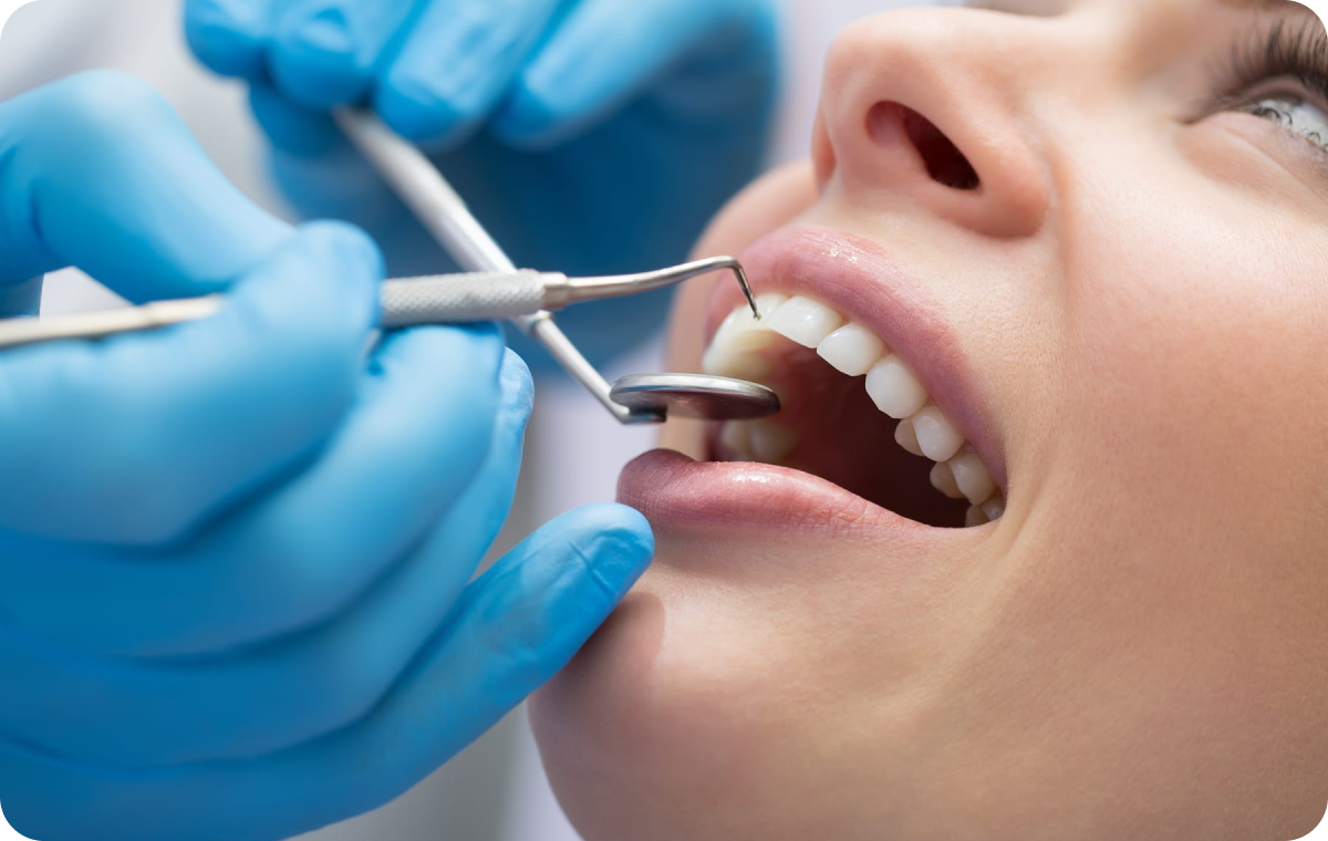 contention biarritz chevauchement dentaire contention biarritz chevauchement dentaire Traitement pluridisciplinaire Dr Loustau-Dessus