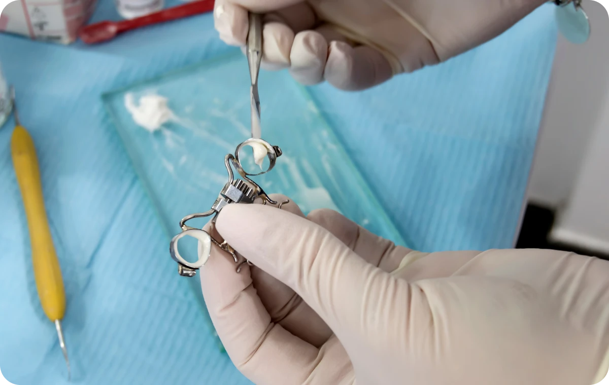 disjoncteur maxillaire biarritz traitement pluridisciplinaire disjoncteur maxillaire biarritz traitement pluridisciplinaire Disjoncteur maxillaire Dr Loustau-Dessus