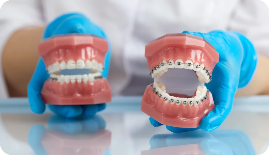 dr loustau dessous biarritz appareils metalliques dr loustau dessous biarritz appareils metalliques Appareils dentaires en métal et céramique Dr Loustau-Dessus