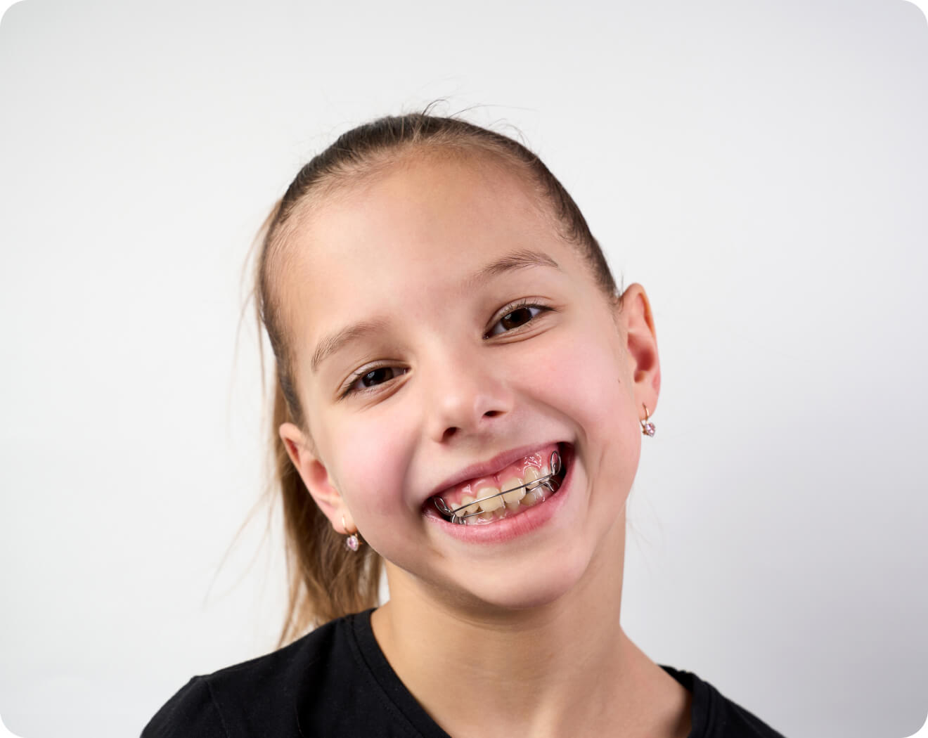 gouttiere biarritz alignement dentaire Accueil Dr Loustau-Dessus