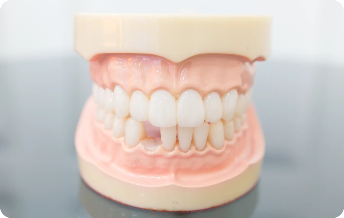 orthodontie enfants biarritz dent manque Dent qui manque ou ne pousse pas Dr Loustau-Dessus