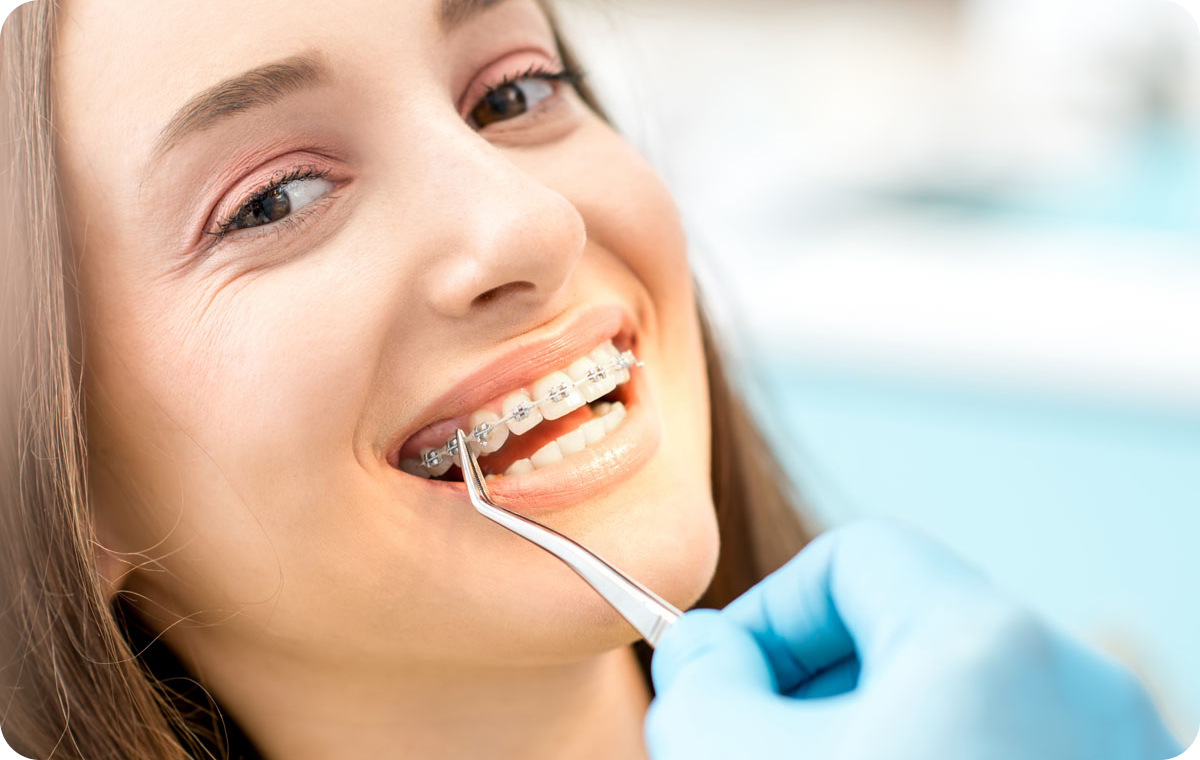 orthodontiste biarritz appareils metal ceramique orthodontiste biarritz appareils metal ceramique Dents qui se chevauchent Dr Loustau-Dessus