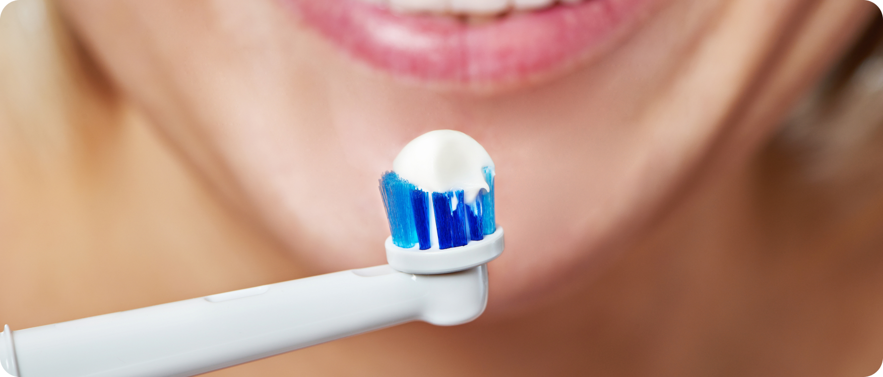 orthodontiste biarritz hygiene bucco dentaire orthodontiste biarritz hygiene bucco dentaire Dents qui se chevauchent Dr Loustau-Dessus