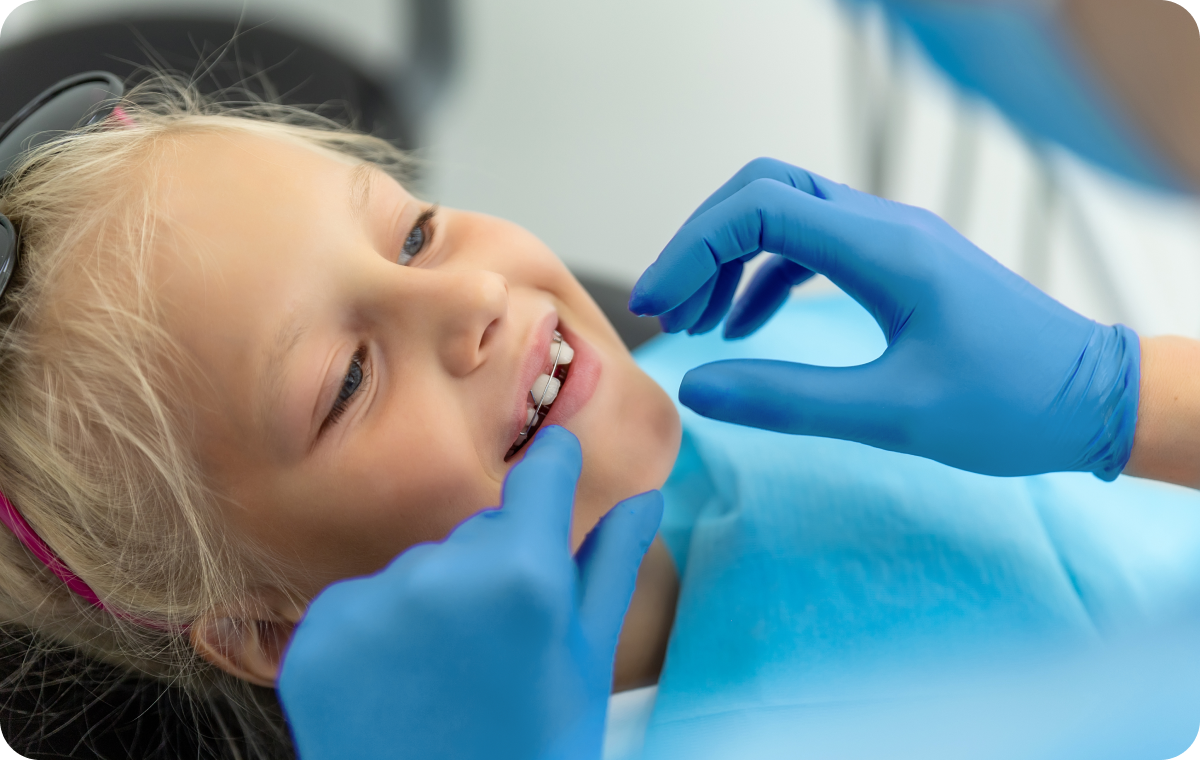 orthodontiste biarritz traitement pluridisciplinaire orthodontiste biarritz traitement pluridisciplinaire ELN (enveloppe linguale nocturne) Dr Loustau-Dessus